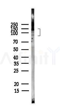 TrkC Antibody - Western blot analysis of lysates from PC12 cells(heat-shock,45min treatment), using TrkC Antibody at 1/1000 dilution.
