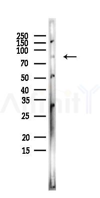 MAPK6/ERK3 Antibody - Western blot analysis of lysates from EC304 cells, using MAPK6/ERK3 Antibody at 1/1000 dilution.