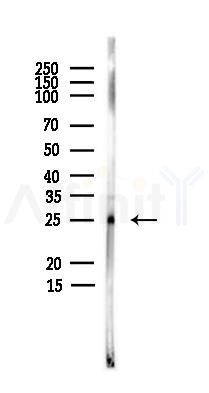 FADD Antibody - Western blot analysis of lysates from PC12 cells(heat-shock,45min treatment), using FADD Antibody at 1/1000 dilution.