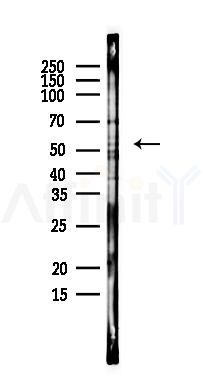 MLKL Antibody - Western blot analysis of lysates from EC304 cells, using MLKL Antibody at 1/1000 dilution.