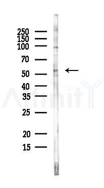 MLKL Antibody - Western blot analysis of lysates from EC304 cells, using MLKL Antibody at 1/1000 dilution.