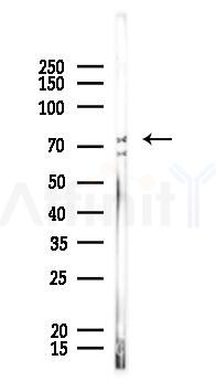 SSH3 Antibody - Western blot analysis of lysates from A375 cells, using SSH3 Antibody at 1/1000 dilution.