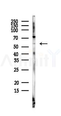 SGK3 Antibody - Western blot analysis of lysates from EC304 cells, using SGK3 Antibody at 1/1000 dilution.