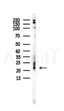 Twist1 Antibody - Western blot analysis of lysates from EC304 cells, using Twist1 Antibody at 1/1000 dilution.