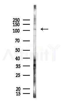 KIF5B Antibody - Western blot analysis of lysates from A375 cells, using KIF5B Antibody at 1/1000 dilution.