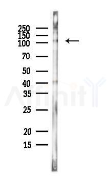 KIF5B Antibody - Western blot analysis of lysates from EC304 cells, using KIF5B Antibody at 1/1000 dilution.