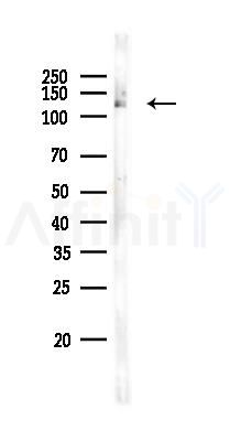 Gli1 Antibody - Western blot analysis of lysates from Mouse muscle, using Gli1 Antibody at 1/1000 dilution.