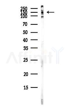 Gli3 Antibody - Western blot analysis of lysates from COLO205 cells(heat-shock,45min treatment), using Gli3 Antibody at 1/1000 dilution.