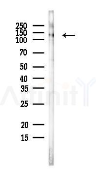 Nephrin Antibody - Western blot analysis of lysates from EC304 cells, using Nephrin Antibody at 1/1000 dilution.