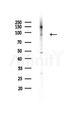 Phospho-LGR5 (Thr842) Antibody - Western blot analysis of lysates from K562 cells(UV,30min treatment), using Phospho-LGR5 (Thr842) Antibody at 1/1000 dilution.