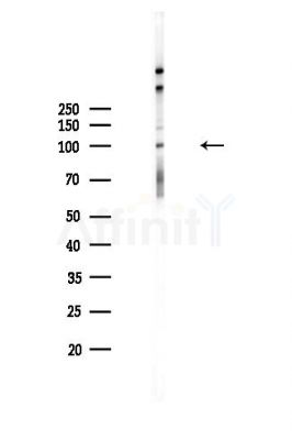 Phospho-CtIP (Ser327) Antibody - Western blot analysis of lysates from MDA-MB-231 cells(heat-shock,45min treatment), using Phospho-CtIP (Ser327) Antibody at 1/1000 dilution.