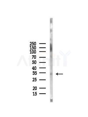 Phospho-CDK4 (Thr172) Antibody - Western blot analysis of lysates from Mouse brain, using Phospho-CDK4 (Thr172) Antibody at 1/1000 dilution.