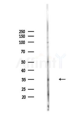 Phospho-PKA alpha  CAT (Ser339) Antibody - Western blot analysis of lysates from MDA-MB-231 cells(heat-shock,45min treatment), using Phospho-PKA alpha  CAT (Ser339) Antibody at 1/1000 dilution.