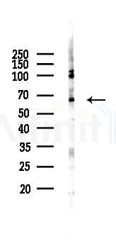 Phospho-Chk2 (Ser19) Antibody - Western blot analysis of lysates from RAW264.