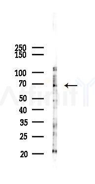 Phospho-Chk2 (Ser19) Antibody - Western blot analysis of lysates from Hela cells(starvation,24h treatment), using Phospho-Chk2 (Ser19) Antibody at 1/1000 dilution.