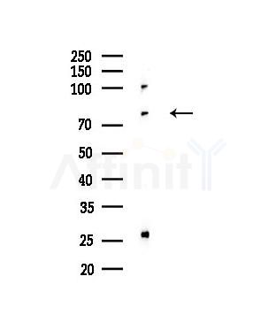 Phospho-B-Myb (Thr494) Antibody - Western blot analysis of lysates from MCF7 cells(heat-shock,45min treatment), using Phospho-B-Myb (Thr494) Antibody at 1/1000 dilution.
