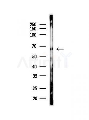 Phospho-Chk2 (Thr26+Ser28) Antibody - Western blot analysis of lysates from PC12 cells(heat-shock,45min treatment), using Phospho-Chk2 (Thr26+Ser28) Antibody at 1/1000 dilution.