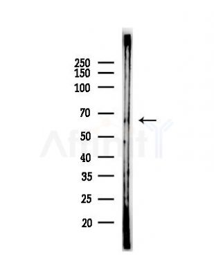 Phospho-Chk2 (Thr26+Ser28) Antibody - Western blot analysis of lysates from HUVEC cells(LPS, 4h treatment), using Phospho-Chk2 (Thr26+Ser28) Antibody at 1/1000 dilution.