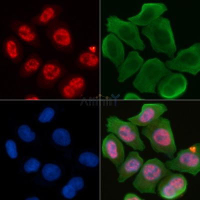 Phospho-4E-BP1 (Thr36) Antibody - AF8045 staining Hela cells(30min of UV treatment) by IF/ICC.