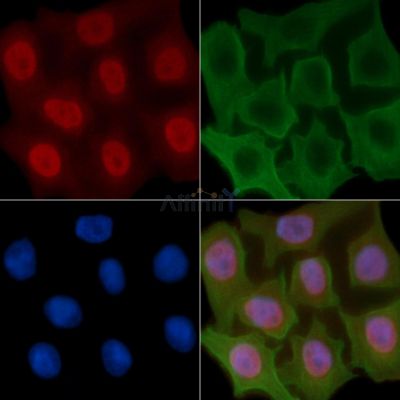 Phospho-p27 Kip1 (Thr157) Antibody - AF8051 staining Hela cells(30min of UV treatment) by IF/ICC.
