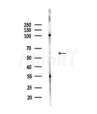 Phospho-Smad2 (Ser245) Antibody - Western blot analysis of lysates from MCF7 cells(heat-shock,45min treatment), using Phospho-Smad2 (Ser245) Antibody at 1/1000 dilution.