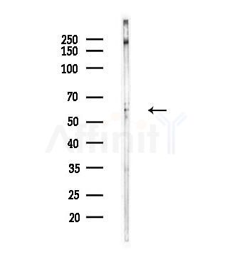 Phospho-Smad2 (Ser245) Antibody - Western blot analysis of lysates from EC304 cells(heat-shock,45min treatment), using Phospho-Smad2 (Ser245) Antibody at 1/1000 dilution.
