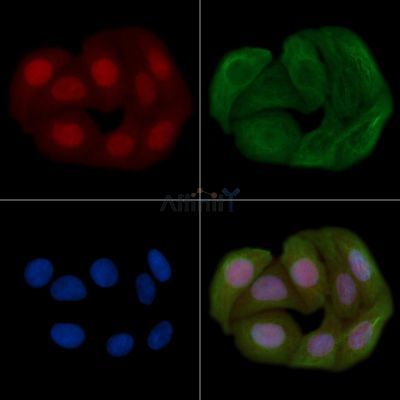 Phospho-Smad2 (Ser245) Antibody - AF8060 staining Hela cells(30min of UV treatment) by IF/ICC.