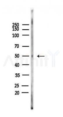 Phospho-Hic-5 (Tyr60) Antibody - Western blot analysis of lysates from Mouse testis, using Phospho-Hic-5 (Tyr60) Antibody at 1/1000 dilution.