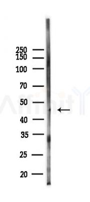 Phospho-Hic-5 (Tyr60) Antibody - Western blot analysis of lysates from 293 cells(heat-shock,45min treatment), using Phospho-Hic-5 (Tyr60) Antibody at 1/1000 dilution.