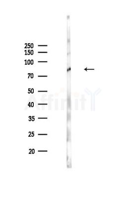 Phospho-MARK2 (Thr596) Antibody - Western blot analysis of lysates from Mouse lung, using Phospho-MARK2 (Thr596) Antibody at 1/1000 dilution.