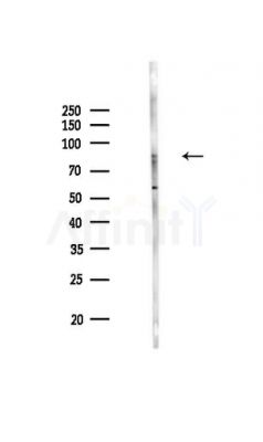 Phospho-MARK2 (Thr596) Antibody - Western blot analysis of lysates from PC12 cells, using Phospho-MARK2 (Thr596) Antibody at 1/1000 dilution.