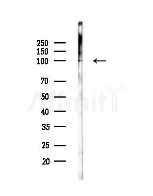 Phospho-DNA Ligase IV (Thr650) Antibody - Western blot analysis of lysates from MCF7 cells(heat-shock,45min treatment), using Phospho-DNA Ligase IV (Thr650) Antibody at 1/1000 dilution.