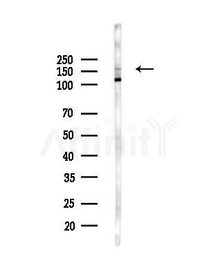 Phospho-TOP2A (Ser1213) Antibody - Western blot analysis of lysates from MCF7 cells(heat-shock,45min treatment), using Phospho-TOP2A (Ser1213) Antibody at 1/1000 dilution.
