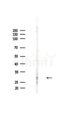 Phospho-Caveolin 2 (Ser23) Antibody - Western blot analysis of lysates from Hela cells(heat-shock,45min treatment), using Phospho-Caveolin 2 (Ser23) Antibody at 1/1000 dilution.