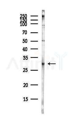 Phospho-Caveolin 2 (Tyr19) Antibody - Western blot analysis of lysates from COLO205 cells(heat-shock,45min treatment), using Phospho-Caveolin 2 (Tyr19) Antibody at 1/1000 dilution.
