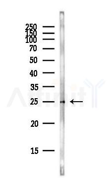 Phospho-Caveolin 2 (Tyr19) Antibody - Western blot analysis of lysates from Rat lung, using Phospho-Caveolin 2 (Tyr19) Antibody at 1/1000 dilution.
