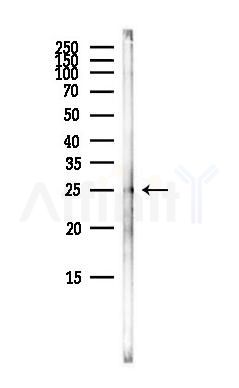 Phospho-Caveolin 2 (Tyr19) Antibody - Western blot analysis of lysates from Mouse brain, using Phospho-Caveolin 2 (Tyr19) Antibody at 1/1000 dilution.