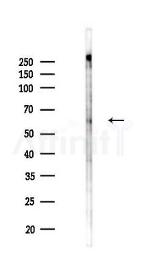 Phospho-LIMK1 (Ser323) Antibody - Western blot analysis of lysates from K562 cells(heat-shock,45min treatment), using Phospho-LIMK1 (Ser323) Antibody at 1/1000 dilution.