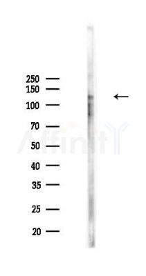 Phospho-FGFR4 (Tyr754) Antibody - Western blot analysis of lysates from PC12 cells(UV,30min treatment), using Phospho-FGFR4 (Tyr754) Antibody at 1/1000 dilution.