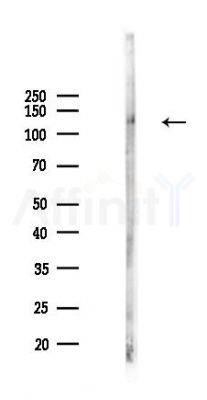 Phospho-FGFR4 (Tyr754) Antibody - Western blot analysis of lysates from HUVEC cells(UV,30min treatment), using Phospho-FGFR4 (Tyr754) Antibody at 1/1000 dilution.