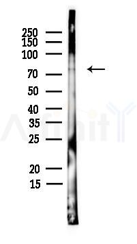 Phospho-PKC delta (Ser664) Antibody - Western blot analysis of lysates from PC12 cells(heat-shock,45min treatment), using Phospho-PKC delta (Ser664) Antibody at 1/1000 dilution.
