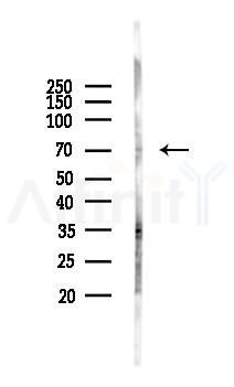 Phospho-ROS (Tyr2274) Antibody - Western blot analysis of lysates from RAW264.