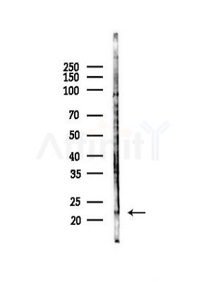 Phospho-BIM (Ser59) Antibody - Western blot analysis of lysates from HepG2 cells(heat-shock, 45min treatment), using Phospho-BIM (Ser59) Antibody at 1/1000 dilution.
