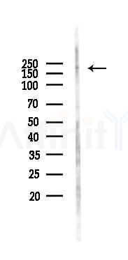 Phospho-CD45 (Tyr1218) Antibody - Western blot analysis of lysates from RAW264.