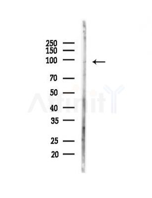 Phospho-DAG1 (Tyr892) Antibody - Western blot analysis of lysates from HepG2 cells(heat-shock, 45min treatment), using Phospho-DAG1 (Tyr892) Antibody at 1/1000 dilution.