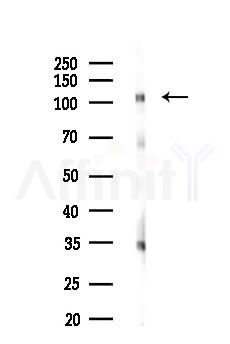 Phospho-AR (Tyr535) Antibody - Western blot analysis of lysates from HUVEC cells(starvation,24h treatment), using Phospho-AR (Tyr535) Antibody at 1/1000 dilution.