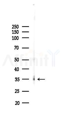 Phospho-Ataxin 3 (Ser256) Antibody - Western blot analysis of lysates from PC12 cells(UV,30min treatment), using Phospho-Ataxin 3 (Ser256) Antibody at 1/1000 dilution.