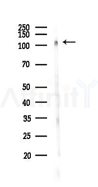 Phospho-BCLAF1 (Ser531) Antibody - Western blot analysis of lysates from 293 cells(UV,30min treatment), using Phospho-BCLAF1 (Ser531) Antibody at 1/1000 dilution.