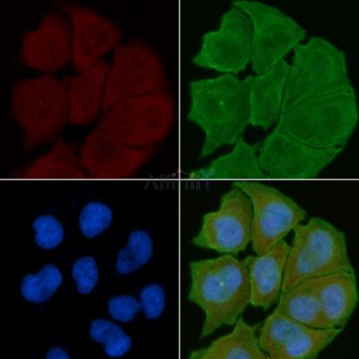 Phospho-Caldesmon (Ser759) Antibody - AF8250 staining Hela cells(30min of UV treatment) by IF/ICC.