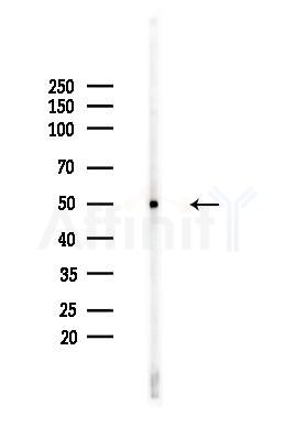 Phospho-p53 (Ser392) Antibody - Western blot analysis of lysates from HUVEC cells(heat-shock,45min treatment), using Phospho-p53 (Ser392) Antibody at 1/1000 dilution.